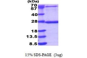 SDS-PAGE (SDS) image for Mitochondrial Ribosomal Protein L48 (MRPL48) (AA 29-212) protein (His tag) (ABIN5853912)