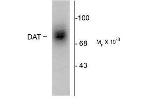 Image no. 1 for anti-Solute Carrier Family 6 (Neurotransmitter Transporter, Dopamine), Member 3 (SLC6A3) (Extracellular Loop) antibody (ABIN372614) (SLC6A3 Antikörper  (Extracellular Loop))