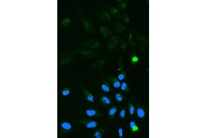 Immunofluorescence analysis of MCF7 cell using UGT1A9 antibody. (UGT1A9 Antikörper  (AA 26-250))
