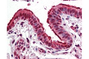 Anti-FOXP1 antibody IHC of human lung, respiratory epithelium.