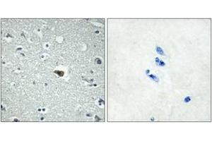 Immunohistochemistry (IHC) image for anti-Brain-Specific Angiogenesis Inhibitor 1 (BAI1) (AA 691-740) antibody (ABIN2890809) (BAI1 Antikörper  (AA 691-740))