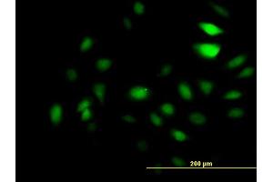 Immunofluorescence of monoclonal antibody to GCN5L2 on HeLa cell. (KAT2A Antikörper  (AA 738-837))