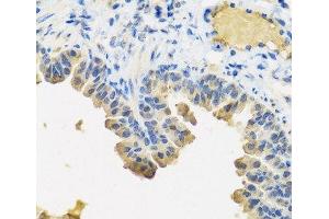 Immunohistochemistry of paraffin-embedded Mouse lung using ANGPT1 Polyclonal Antibody at dilution of 1:100 (40x lens). (Angiopoietin 1 Antikörper)