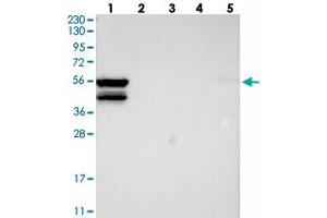 Western blot analysis of Lane 1: RT-4, Lane 2: U-251 MG, Lane 3: Human Plasma, Lane 4: Liver, Lane 5: Tonsil with MKS1 polyclonal antibody . (MKS1 Antikörper)