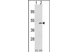 Western blot analysis of TRIB2 (arrow) using rabbit polyclonal TRIB2 N-term (ABIN652876 and ABIN2842567). (TRIB2 Antikörper  (N-Term))