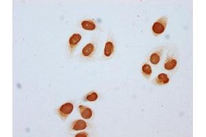 Immunocytochemistry analysis of ABIN7139202 diluted at 1:5 and staining in Hela cells (treated with 30mM sodium butyrate for 4h) performed on a Leica BondTM system.