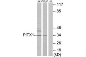 Western Blotting (WB) image for anti-Paired-Like Homeodomain 1 (PITX1) (AA 121-170) antibody (ABIN2889533) (PITX1 Antikörper  (AA 121-170))