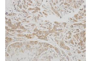Immunohistochemistry (IHC) image for anti-Serpin Peptidase Inhibitor, Clade G (C1 Inhibitor), Member 1 (SERPING1) (Center) antibody (ABIN2856082)