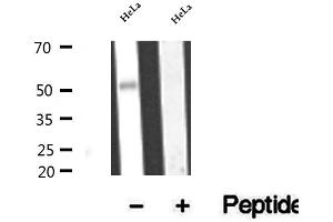 Western blot analysis of extracts of HeLa cells, using BBS4 antibody. (BBS4 Antikörper  (Internal Region))