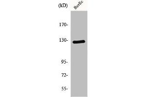 Western Blot analysis of HuvEc cells using MSH3 Polyclonal Antibody (MSH3 Antikörper  (N-Term))
