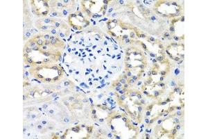 Immunohistochemistry of paraffin-embedded Rat kidney using SCG3 Polyclonal Antibody at dilution of 1:100 (40x lens). (SCG3 Antikörper)