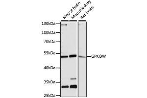 Western blot analysis of extracts of various cell lines, using GPKOW antibody (ABIN6293325) at 1:3000 dilution.