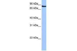 WB Suggested Anti-UBQLN3 Antibody Titration: 0. (Ubiquilin 3 Antikörper  (N-Term))