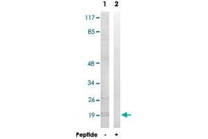 Western blot analysis of extracts from K-562 cells, using MRPL51 polyclonal antibody . (MRPL51 Antikörper)