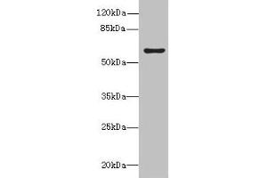 Western blot All lanes: KHDC4 antibody at 5 μg/mL + Mouse liver tissue Secondary Goat polyclonal to rabbit IgG at 1/10000 dilution Predicted band size: 65, 60, 41, 25 kDa Observed band size: 65 kDa (UPF0469 Protein KIAA0907 (KHDC4) (AA 1-241) Antikörper)