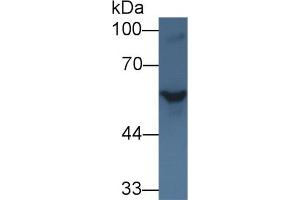 Western blot analysis of Rat Serum, using Rat SHH Antibody (1 µg/ml) and HRP-conjugated Goat Anti-Rabbit antibody ( (Sonic Hedgehog Antikörper  (AA 237-399))