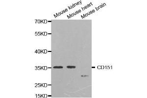 Western blot analysis of extracts of various cell lines, using CD151 antibody. (CD151 Antikörper  (AA 113-221))