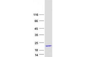 Western Blotting (WB) image for Chromosome 19 Open Reading Frame 10 (C19orf10) protein (Myc-DYKDDDDK Tag) (ABIN2731888)