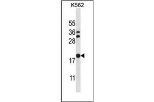 Western blot analysis of Stathmin-3 / STMN3 Antibody (C-term) in K562 cell line lysates (35ug/lane). (Stathmin 3 Antikörper  (C-Term))