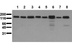 Western Blotting (WB) image for anti-Met Proto-Oncogene (MET) (Activation Domain) antibody (ABIN492622) (c-MET Antikörper  (Activation Domain))