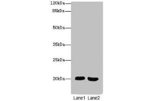 Western blot All lanes: MSRB2antibody at 2. (MSRB2 Antikörper  (AA 10-182))