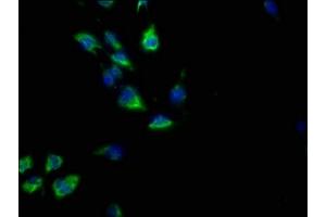 Immunofluorescence staining of U251 cells with ABIN7139867 at 1:50, counter-stained with DAPI.