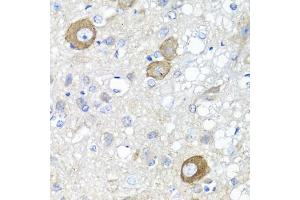 Immunohistochemistry of paraffin-embedded rat brain using NRG4 antibody (ABIN1873958) at dilution of 1:100 (40x lens). (Neuregulin 4 Antikörper)