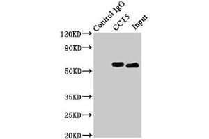 Immunoprecipitating CCT5 in Hela whole cell lysate Lane 1: Rabbit control IgG (1 μg) instead of ABIN7171417 in Hela whole cell lysate. (CCT5 Antikörper  (AA 1-270))