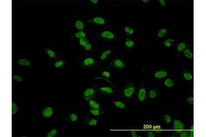 Image no. 6 for anti-Cytidine Monophosphate N-Acetylneuraminic Acid Synthetase (CMAS) (AA 164-264) antibody (ABIN466224) (CMAS Antikörper  (AA 164-264))