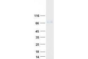 Western Blotting (WB) image for RYK Receptor-Like Tyrosine Kinase (RYK) (Transcript Variant 1) protein (Myc-DYKDDDDK Tag) (ABIN2734730)