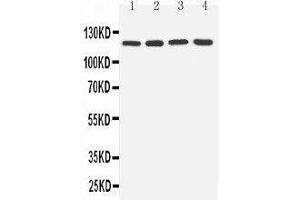 Anti-TLR7 antibody, Western blotting Lane 1: Rat Spleen Tissue Lysate Lane 2: Rat Liver Tissue Lysate Lane 3: U87 Cell Lysate Lane 4: A549 Cell Lysate (TLR7 Antikörper  (C-Term))