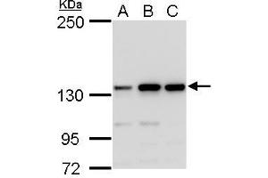 WB Image MSH3 antibody detects MSH3 protein by western blot analysis.
