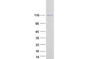 Western Blotting (WB) image for Ectonucleotide pyrophosphatase/phosphodiesterase 3 (ENPP3) protein (Myc-DYKDDDDK Tag) (ABIN2713498)
