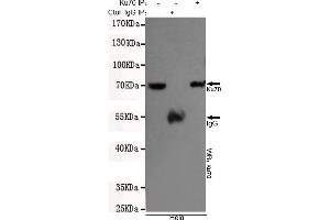 Immunoprecipitation analysis of Hela cell lysates using Ku70 mouse mAb. (XRCC6 Antikörper)