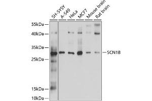 Western blot analysis of extracts of various cell lines, using SCN1B antibody (ABIN6132634, ABIN6147433, ABIN6147434 and ABIN6214194) at 1:1000 dilution. (SCN1B Antikörper  (AA 19-160))