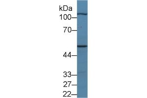 Western Blot; Sample: Porcine Skeletal muscle lysate; Primary Ab: 2µg/ml Rabbit Anti-Human MYPN Antibody Second Ab: 0. (Myopalladin Antikörper  (AA 945-1320))