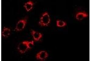 Immunofluorescent analysis of S100-A11 staining in SKOV3 cells.