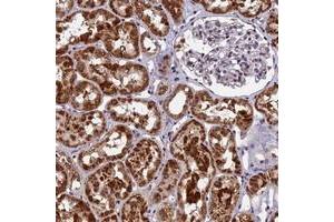 Immunohistochemical staining of human kidney with CMC1 polyclonal antibody  shows strong cytoplasmic positivity in cells in tubules. (CMC1 Antikörper)