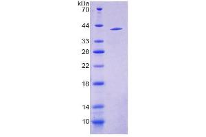 SDS-PAGE analysis of Human S17aH Protein. (CYP17A1 Protein)