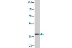 Western Blot detection against Immunogen (34. (RBM3 Antikörper  (AA 1-80))