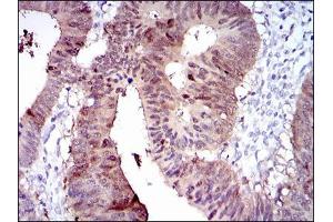 Immunohistochemistry (IHC) image for anti-Cytochrome P450, Family 1, Subfamily A, Polypeptide 1 (CYP1A1) antibody (ABIN969511)