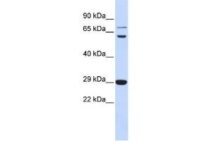 WB Suggested Anti-CD40LG Antibody Titration:  0. (CD40 Ligand Antikörper  (Middle Region))