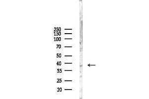 anti-Lumican (LUM) (N-Term) antibody