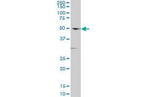 TGFBR1 polyclonal antibody (A01), Lot # ABNOVA060606QCS1. (TGFBR1 Antikörper  (AA 30-125))