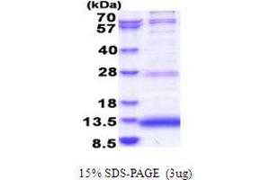Jumping Translocation Breakpoint (JTB) (AA 31-105) protein (His tag)