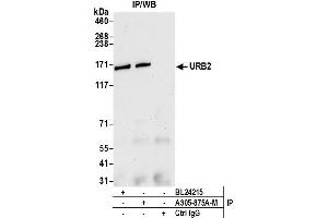 Immunoprecipitation (IP) image for anti-URB2 Ribosome Biogenesis 2 Homolog (URB2) (AA 1474-1524) antibody (ABIN7449667) (URB2 Antikörper  (AA 1474-1524))