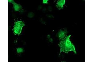 Image no. 3 for anti-Low Density Lipoprotein Receptor Adaptor Protein 1 (LDLRAP1) antibody (ABIN1496689) (LDLRAP1 Antikörper)