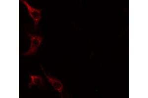ABIN6267612 staining HeLa cells by IF/ICC. (LIPE Antikörper  (pSer552))