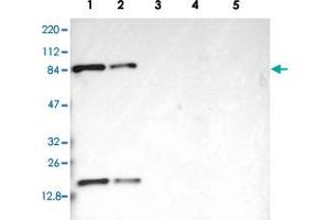 Western blot analysis of Lane 1: RT-4, Lane 2: U-251 MG, Lane 3: Human Plasma, Lane 4: Liver, Lane 5: Tonsil with CD2AP polyclonal antibody  at 1:250-1:500 dilution.