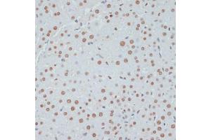 Immunohistochemistry of paraffin-embedded rat liver using Phospho-p53-S33 antibody (ABIN6135330, ABIN6136276, ABIN6136277 and ABIN6225656) at dilution of 1:100 (40x lens). (p53 Antikörper  (pSer33))